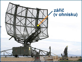 Radar